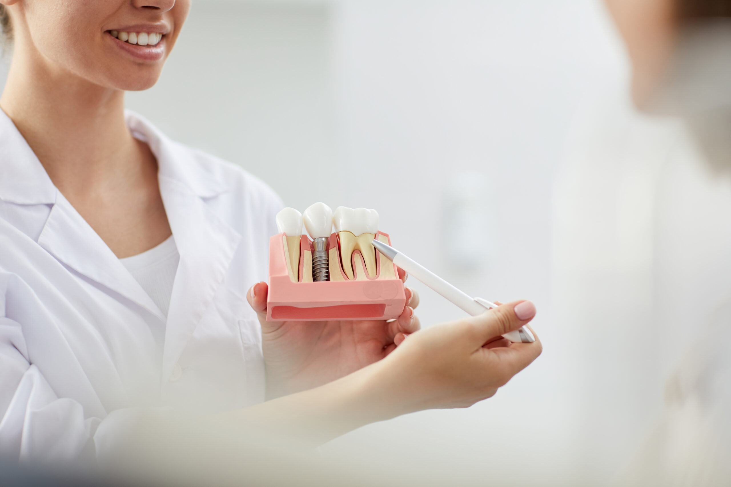 Implantes Dentales Inmediatos. Las ventajas de una técnica efectiva
